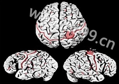 2013款硅胶制冰球 2013款硅胶制冰球